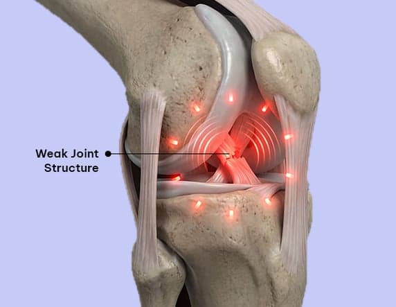 Why Science of Advanced Joint Strength?