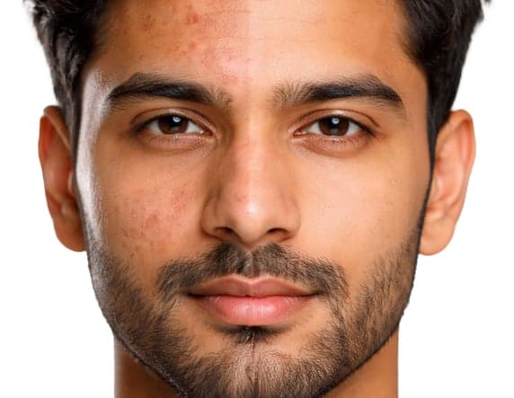 Why Collagen?