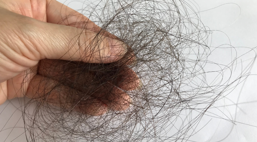 hair fall