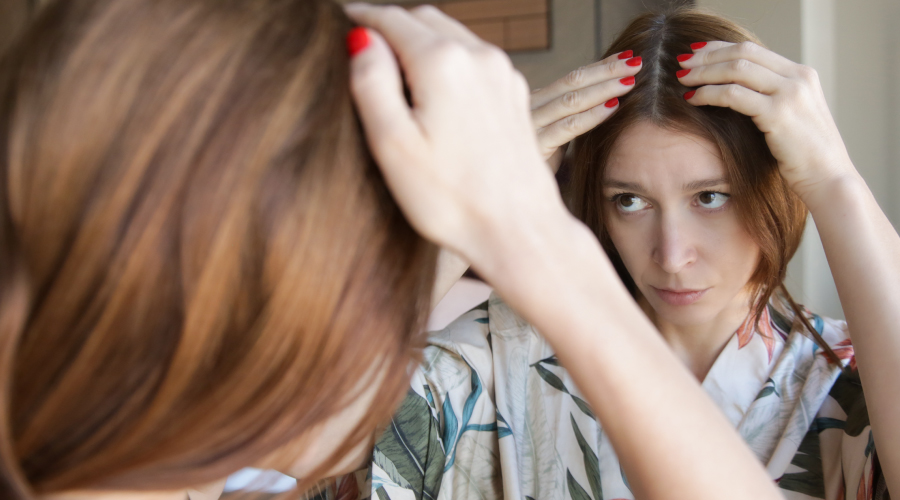 Types of Hair fall