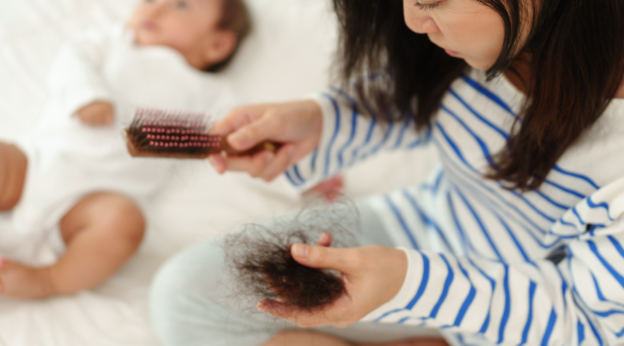 postpartum hair loss