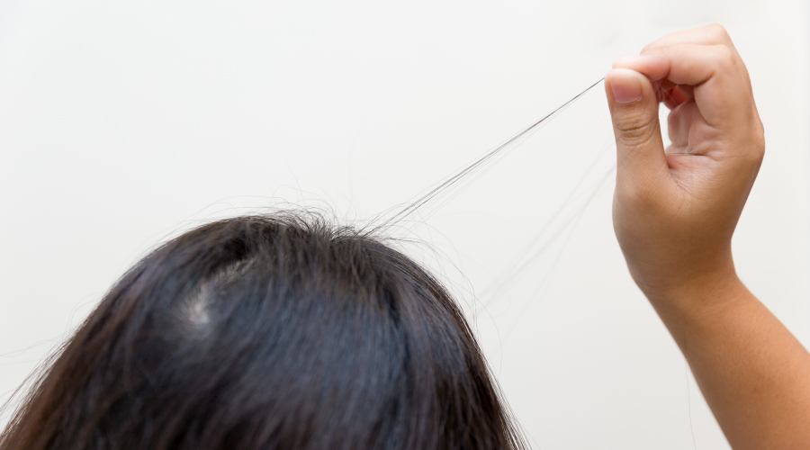 trichotillomania treatment