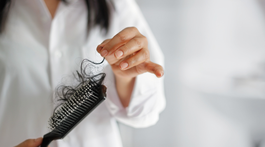 Stress hair loss female