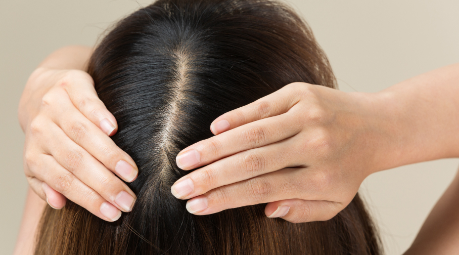 scalp shampoo