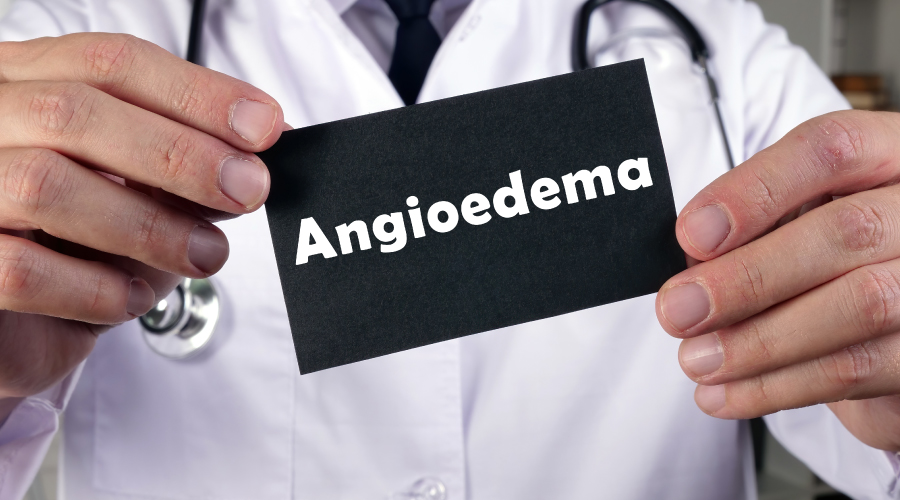 Angioedema