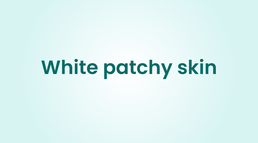 White Patchy Skin