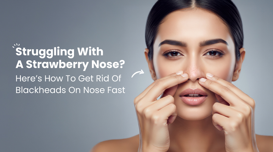 Struggling with a Strawberry Nose? Here’s How to Get Rid of Blackheads on Nose Fast