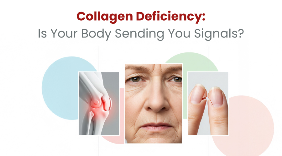 Collagen Deficiency