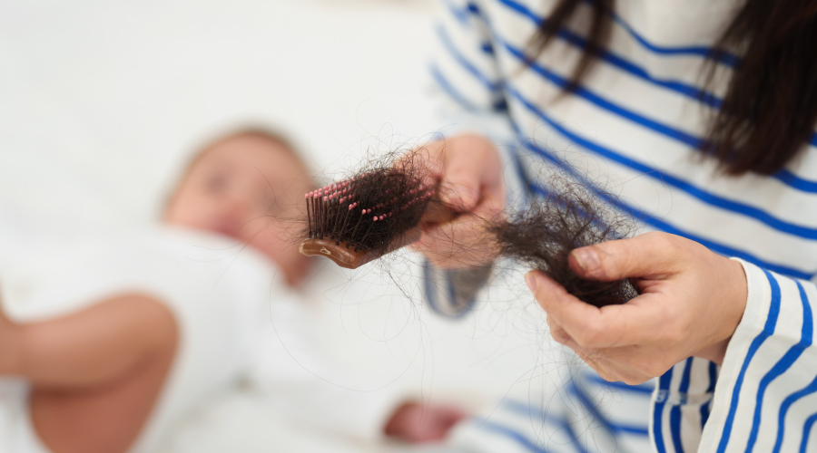 Postpartum hair loss